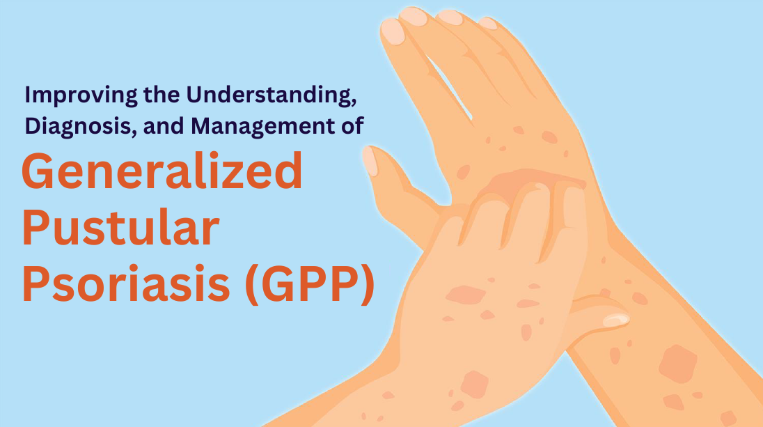 Improving The Understanding, Diagnosis, And Management Of Generalized ...